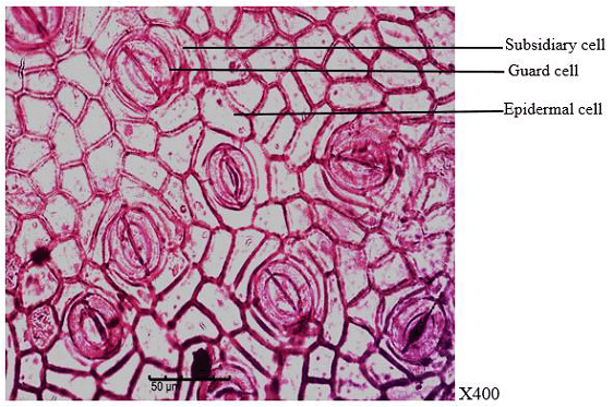 Figure 3. Abaxial (lower) surface of the leaf of P. nitida showing polygonally-shaped epidermal cells. Stomata are present (paracytic type). Trichomes are absent.