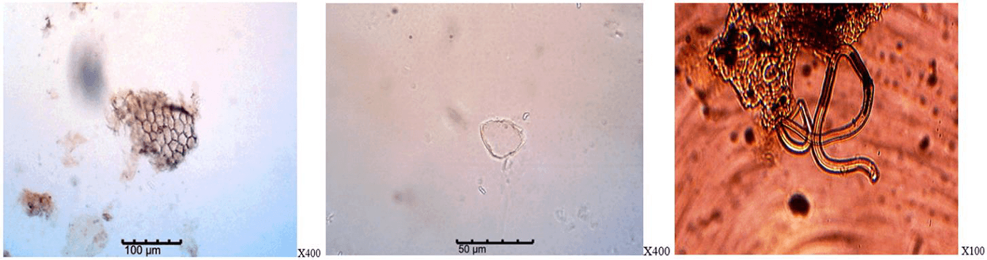 Figure 6. Photomicrograph of the powdered leaf of P. nitida.