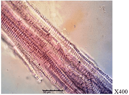 Figure 5. Chemomicroscopy of powdered leaf of P. nitida.