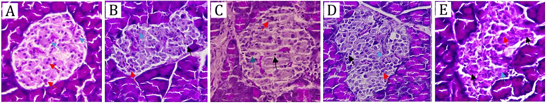 Figure 1. Histopathological analysis of pancreatic tissue (400×, Gomori staining). Representative sections show: (A) Normal group, (B) Diabetic control, (C) Diabetic + glibenclamide, (D) Diabetic + FEADSN 100 mg/kg, and (E) Diabetic + FEADSN 150 mg/kg. Scale bar = 50 µm. Red arrows indicate α-cells, blue arrows indicate β-cells, and black arrows indicate necrotic areas.