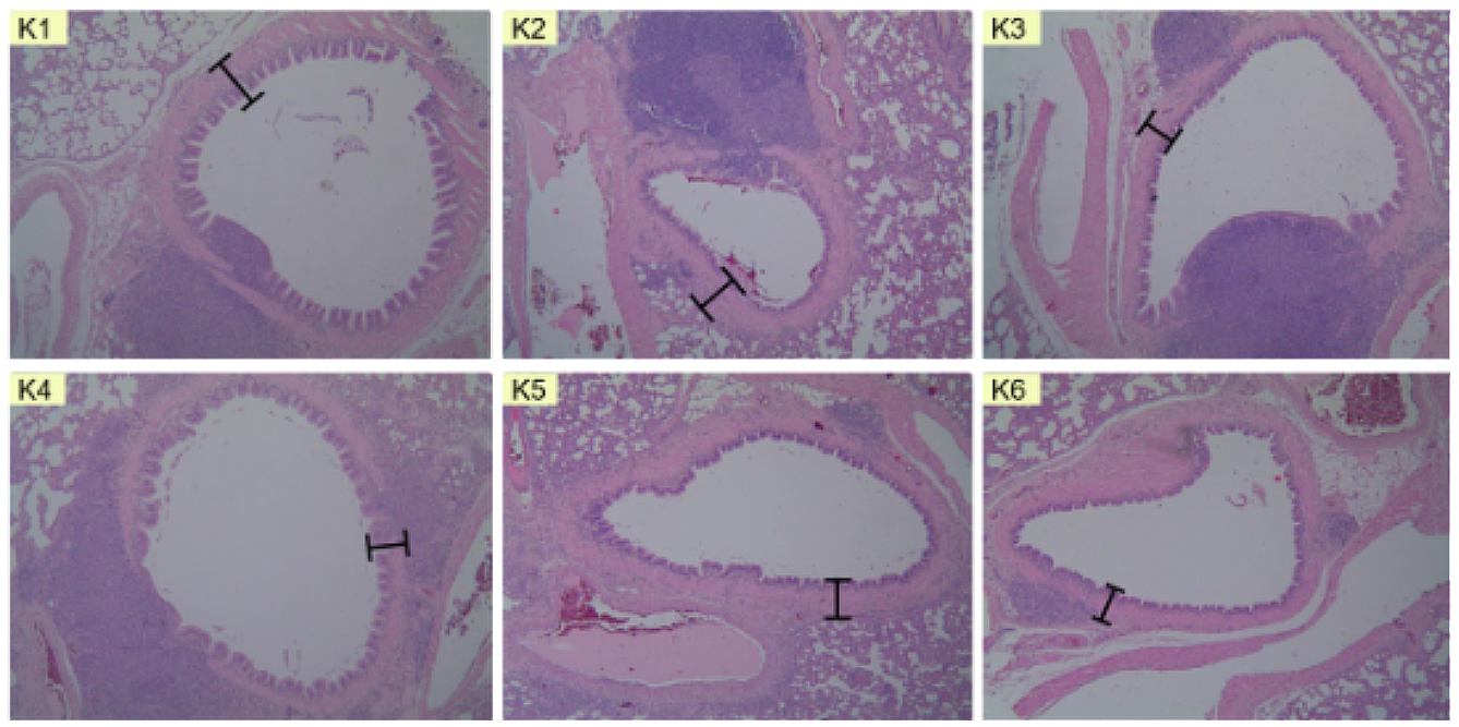 Potential of Ciplukan Leaf (Physalis Angulate L.) Infusion as A Bronchodilator in Pulmonary Histopathology of Sprague Dawley White Rats