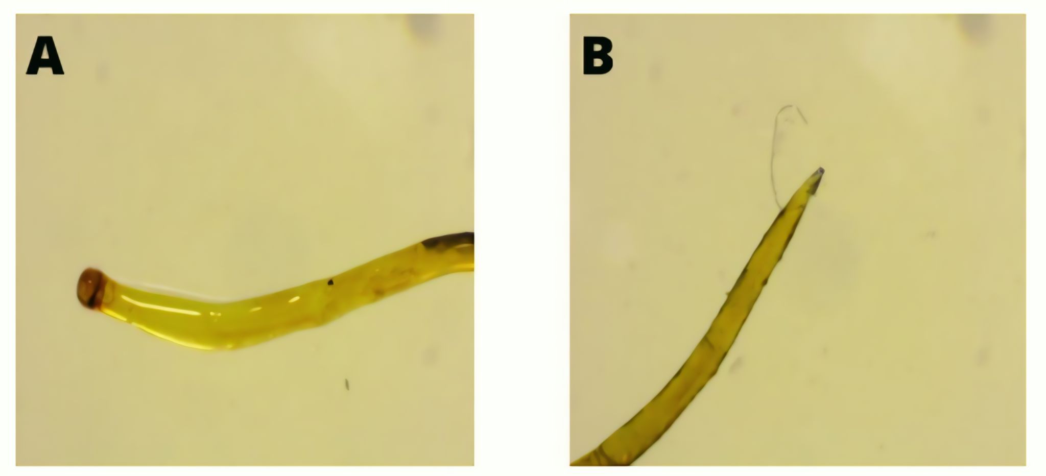 Figure 5. Morphology of Camallanus sp. Note: (A) anterior (head) and (B) posterior (tail).