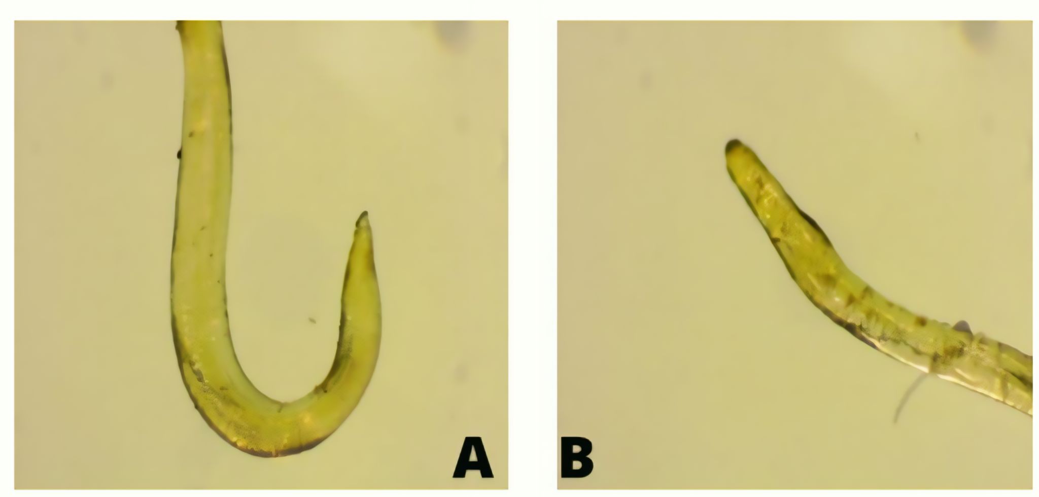 Figure 3. Morphological features of Anisakis sp. Note: (A) anterior and (B) posterior.