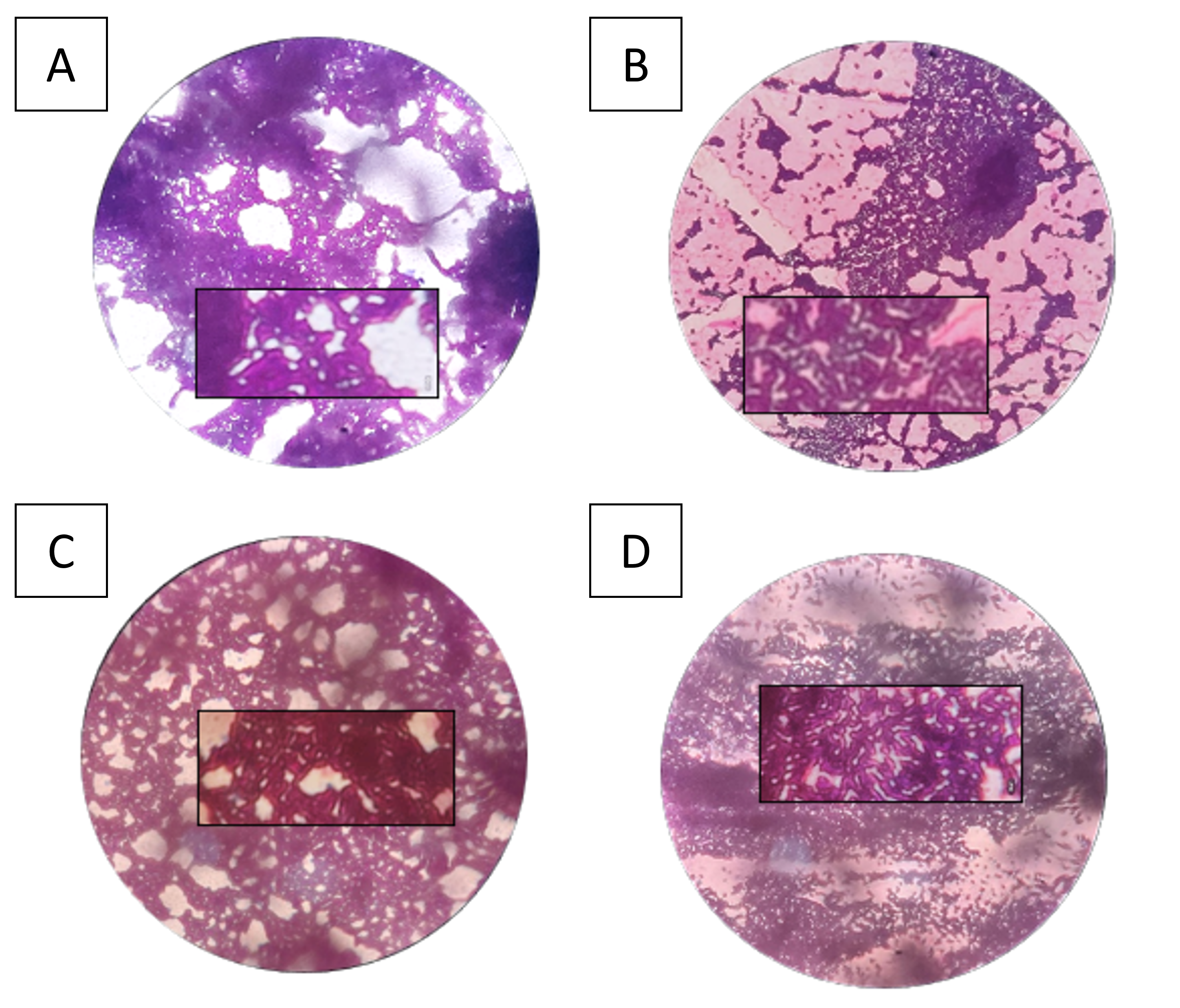 Figure 4. Microscopic observation of the morphology of lactic acid bacteria cells A. 0 h, B. 3 h, C. 4 h, D. 5 h.