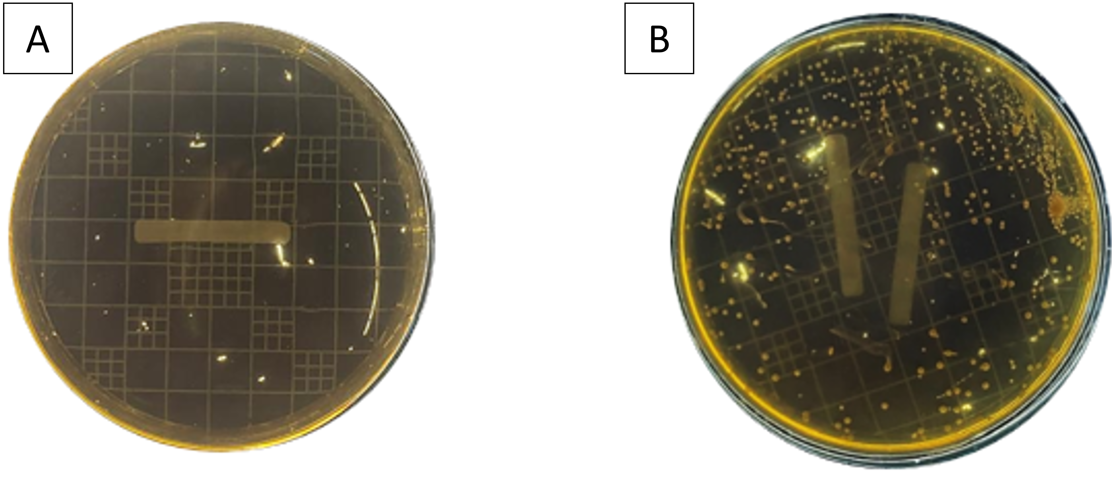 Figure 3. A Control, B Bacterial isolates growing in MRSA medium.