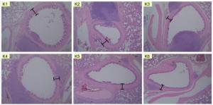 Potential of Ciplukan Leaf (Physalis Angulate L.) Infusion as A Bronchodilator in Pulmonary Histopathology of Sprague Dawley White Rats Figures